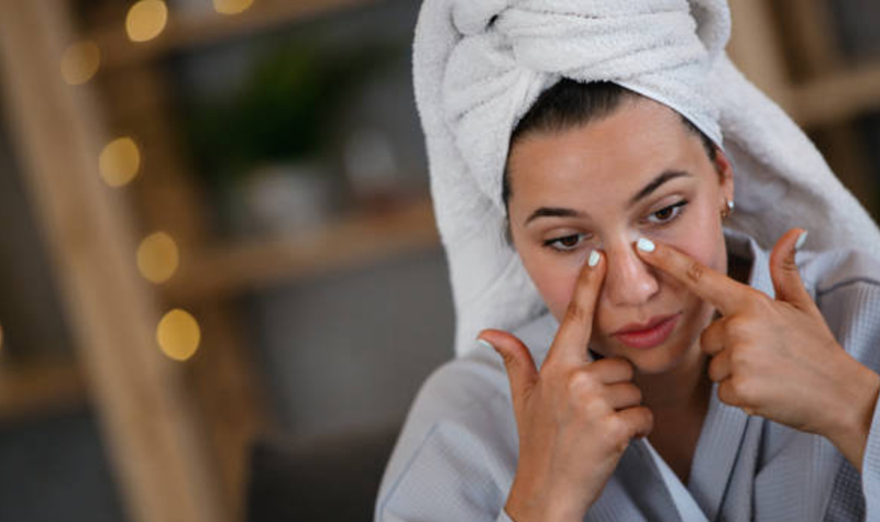 Woman rubbing cream under her eyes