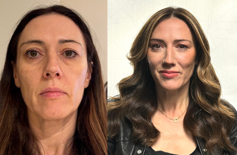 Before and after image of a woman with a new hair colour